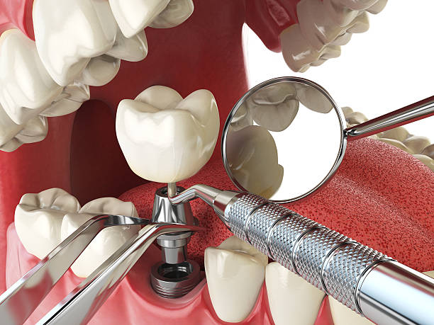 Best Emergency Treatment for Jaw Pain or Injury in Ridgemark, CA